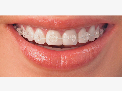 Dental Clinic in Kodakara | Skylar Dental Clinic