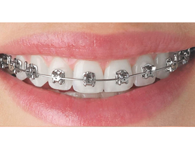 Dental Clinic in Kodakara | Skylar Dental Clinic
