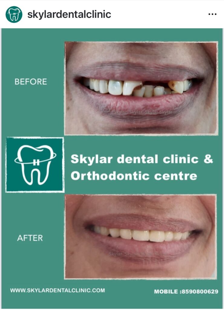 Dental Clinic in Kodakara | Skylar Dental Clinic