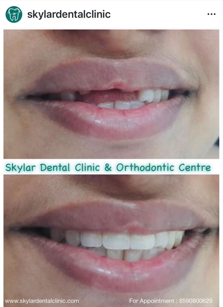 Dental Clinic in Kodakara | Skylar Dental Clinic