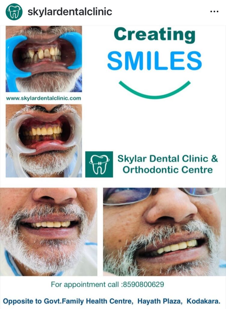 Dental Clinic in Kodakara | Skylar Dental Clinic