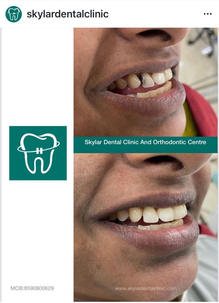 Dental Clinic in Kodakara | Skylar Dental Clinic