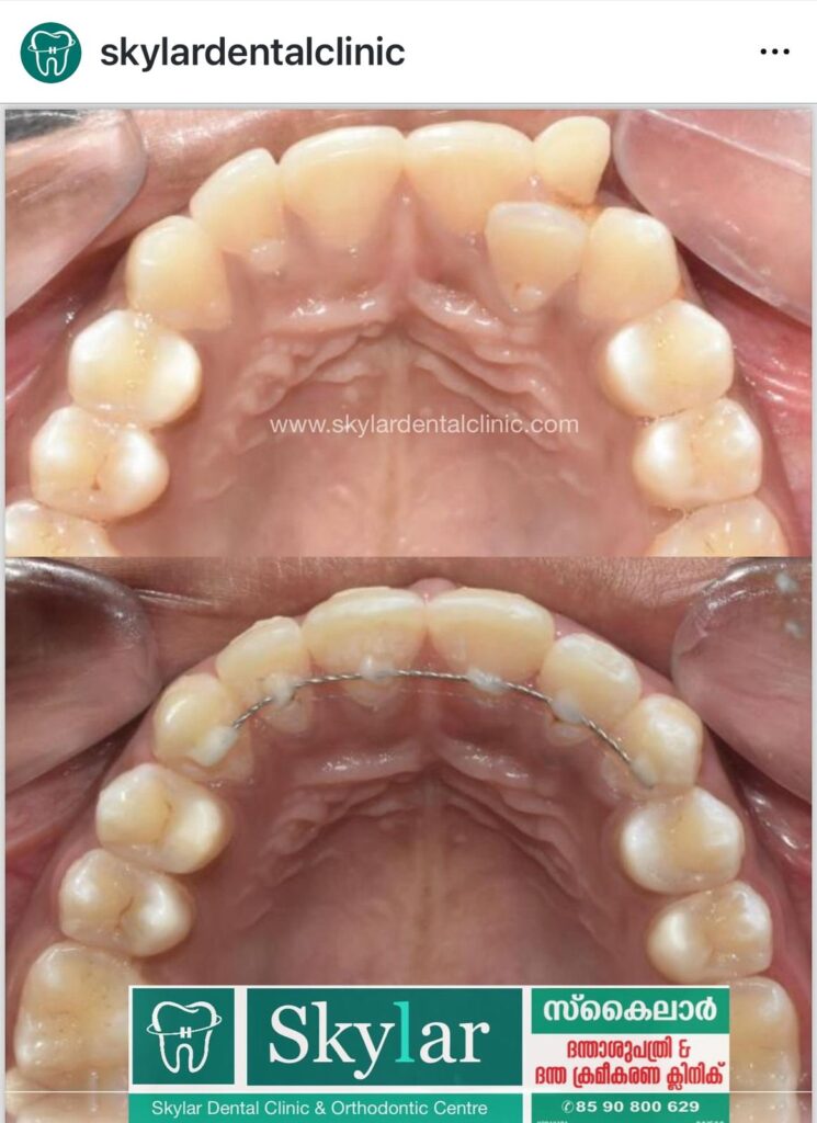 Dental Clinic in Kodakara | Skylar Dental Clinic