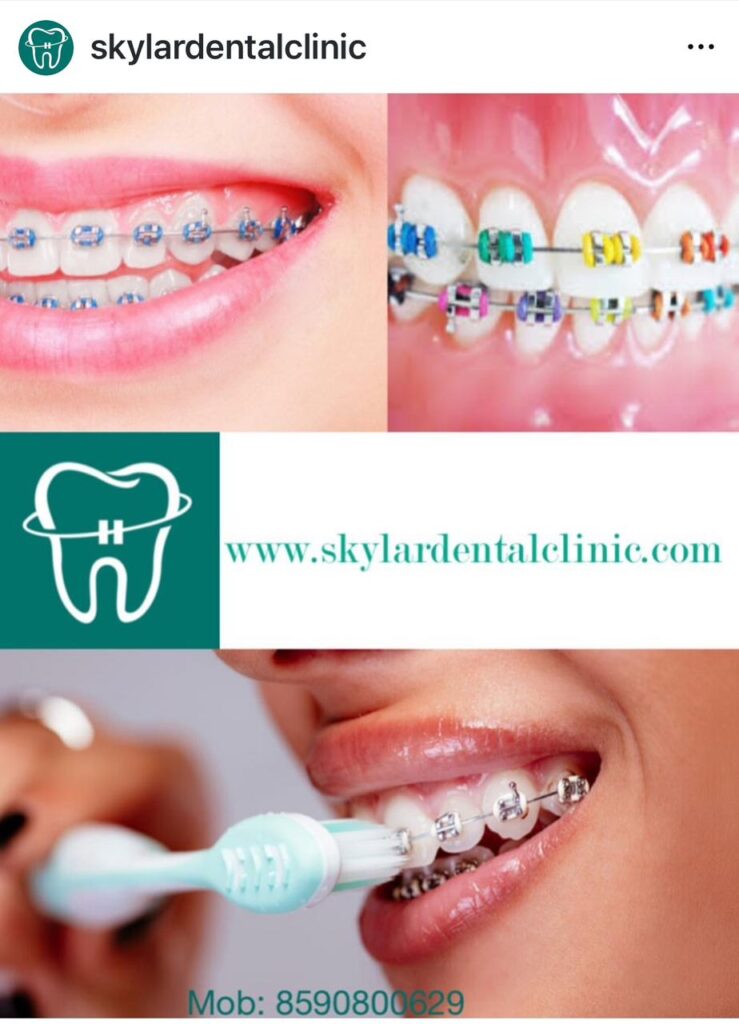 Dental Clinic in Kodakara | Skylar Dental Clinic